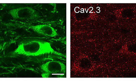Blockade spezieller Kalzium-Kanäle kann Nervenzellen retten